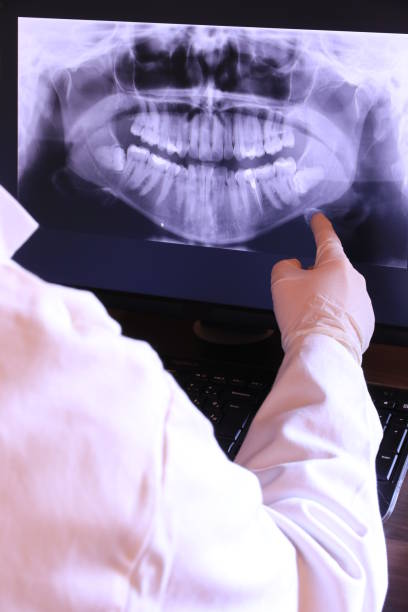Best Emergency Root Canal Treatment in Ralls, TX