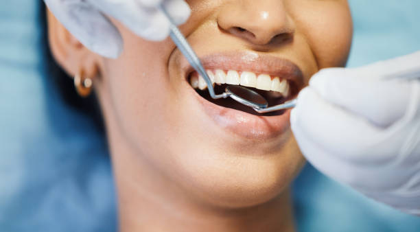 Best Same-Day Emergency Dentist in Ralls, TX