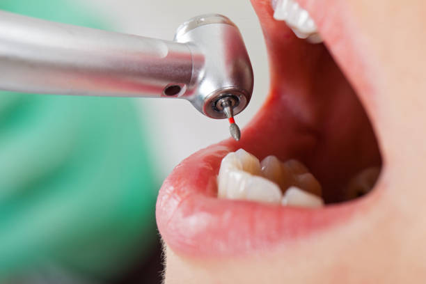 Best Same-Day Emergency Dentist in Ralls, TX